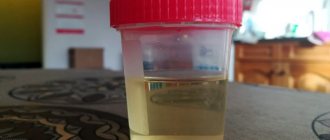 What does normal urine look like in cats?