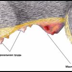 Mastitis (picture)