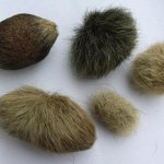 trichobezoars (hairballs)